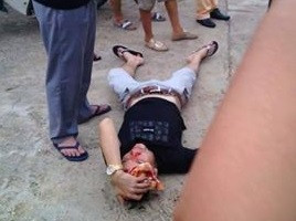 Nam thanh niên cắn tay CSGT sau khi chống đối cảnh sát ở TP Tuyên Quang ngày 30/6. 