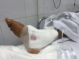 Vụ mổ nhầm chân ở BV Việt Đức: Bác sỹ thừa nhận không đọc bệnh án?