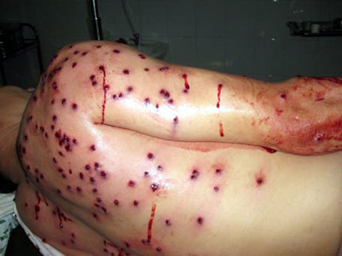 Kẻ vác súng hoa cải bắn người ở Bắc Giang ra đầu thú