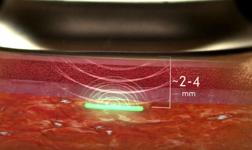 Cảm biến được làm bằng vật liệu tổng hợp hydrogel mềm mỏng tương tự như kính áp tròng