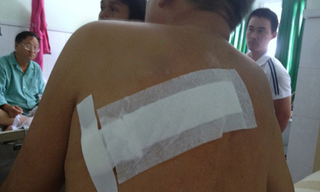 Vết thương dài sau lưng ông Hùng