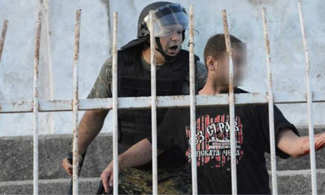 CĐV không may bị mất bàn tay trái vì lựu đạn.