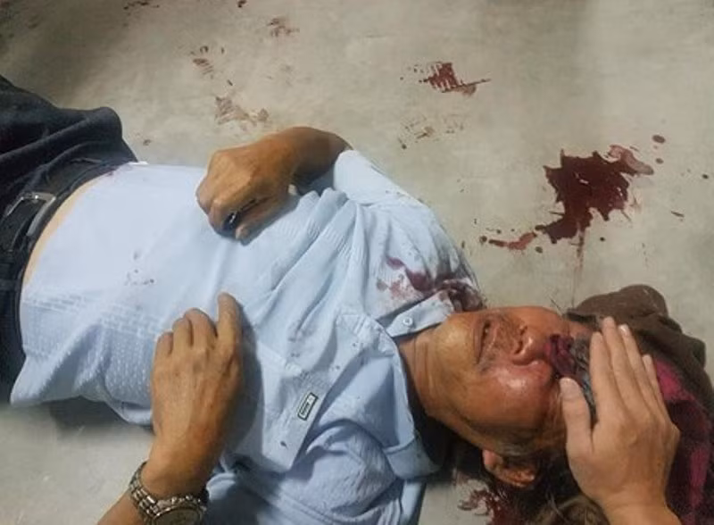 Ông Quang bị bảo vệ chung cư đánh trọng thương.