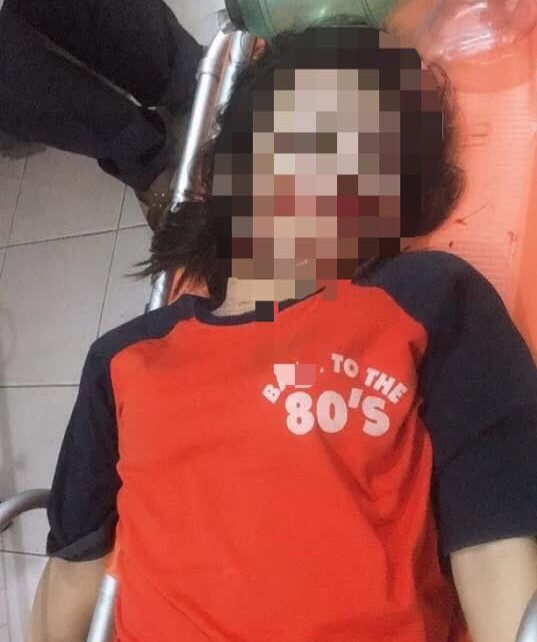 Vướng phải dây điện trên đường, nữ sinh 17 tuổi tử vong