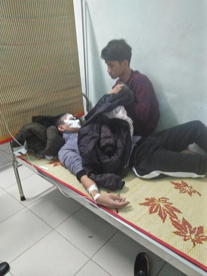 Dùng lửa 'thử' chất lượng xăng, một thanh niên nhập viện