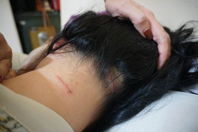 Chị Trang được đưa đi giám định với tỷ lệ thương tật 12%.