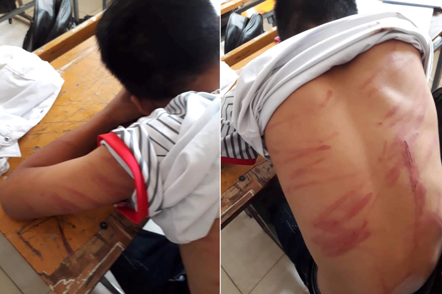 Người bố khai lý do đánh con ngất xỉu phải nhập viện