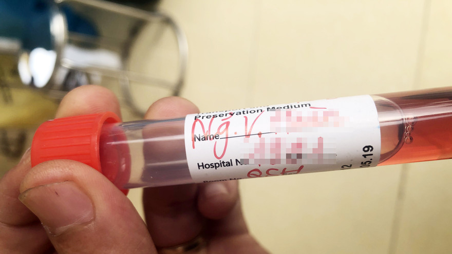 Ảnh: mẫu xét nghiệm minh họa