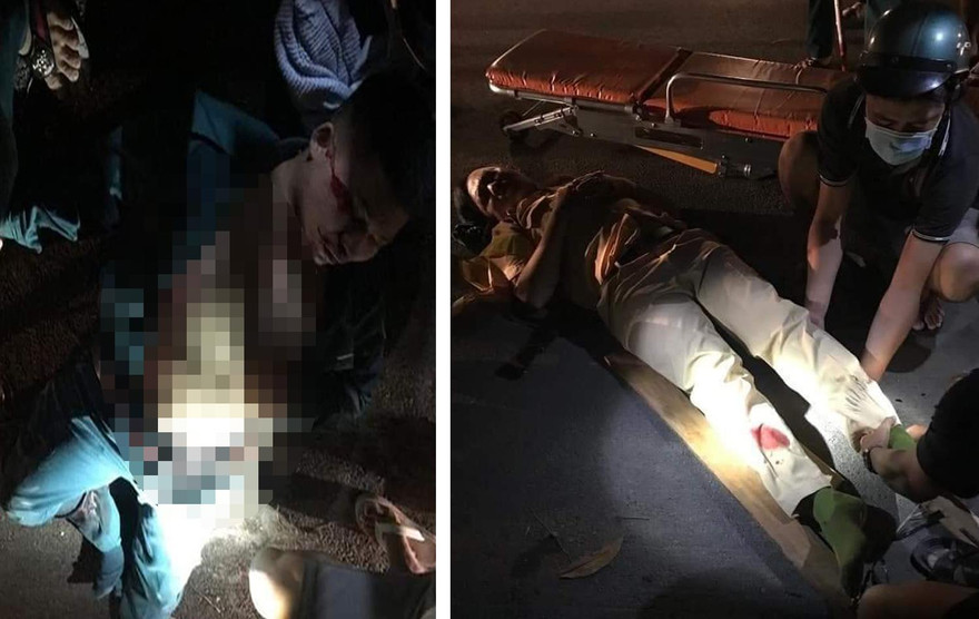 Cán bộ CSGT và dân phòng bị tông gãy chân.