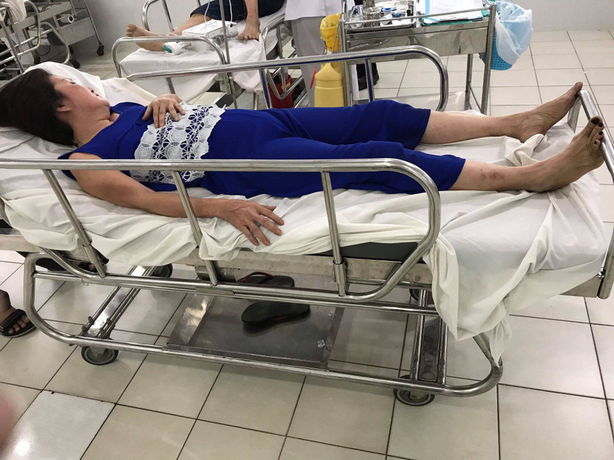 Bà Hoa bị nhóm côn đồ hành hung gãy 2 đốt sống.