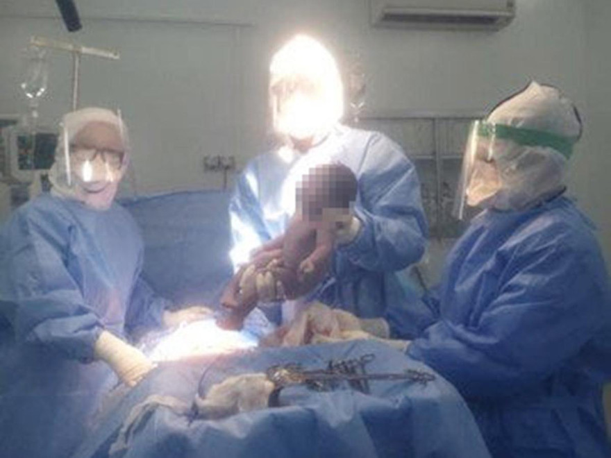 Ca mổ bắt con thành công cho thai phụ mắc COVID-19.