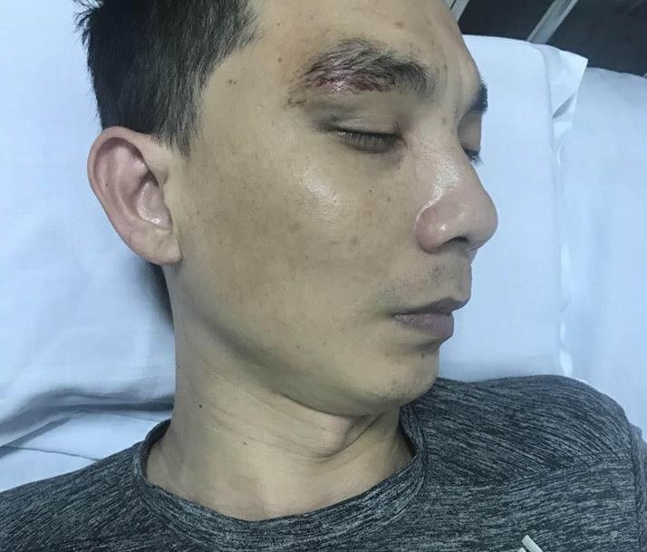 Dân tố bị thương tích sau khi tới công an phường làm việc