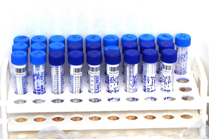 Bệnh nhân được xét nghiệm lần đầu cho kết quả âm tính.