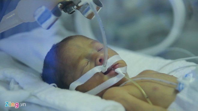 Bé Trần Gấu đã được xuất viện sau hai tháng điều trị đặc biệt. 