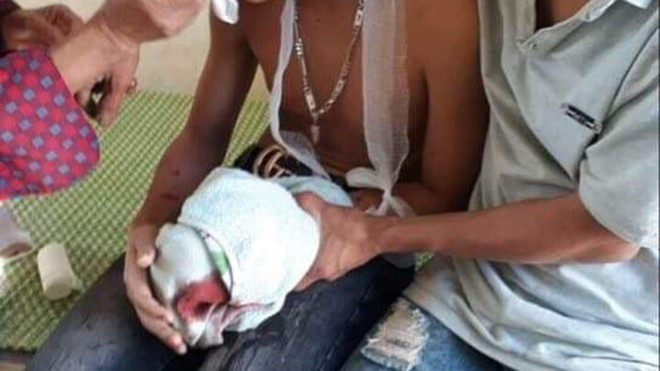 Vụ laptop phát nổ khiến 3 học sinh nhập viện cấp cứu: Không có pin sao vẫn phát nổ?