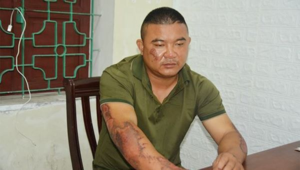 Lộ nguyên nhân gã đàn ông tưới xăng đốt nhà khiến 5 người nhập viện