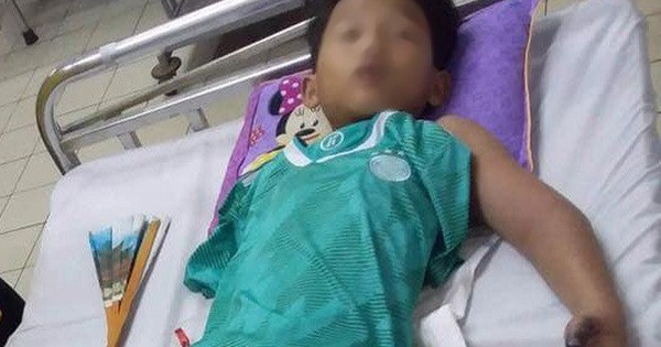 Ra đồng bắt cua bé trai 11 tuổi bị rắn hổ mang cắn nguy kịch