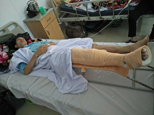 Một nạn nhân điều trị tại bệnh viện