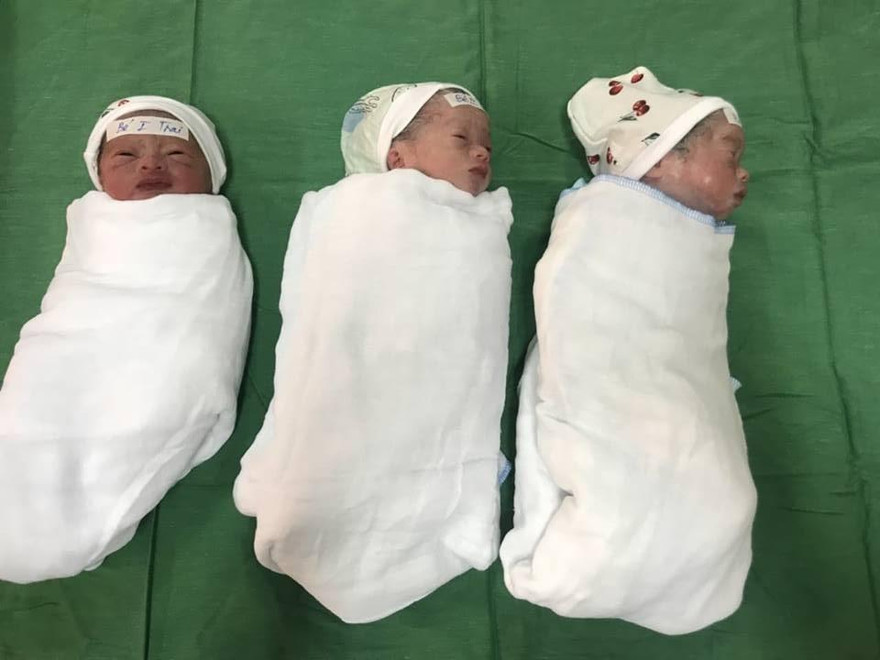 Nghệ An: Sản phụ 23 tuổi sinh 3 hiếm gặp 