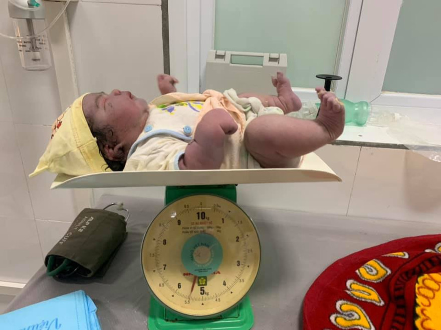 Kỳ tích sản phụ sinh thường bé gái nặng 5,5kg tại huyện miền núi Nghệ An