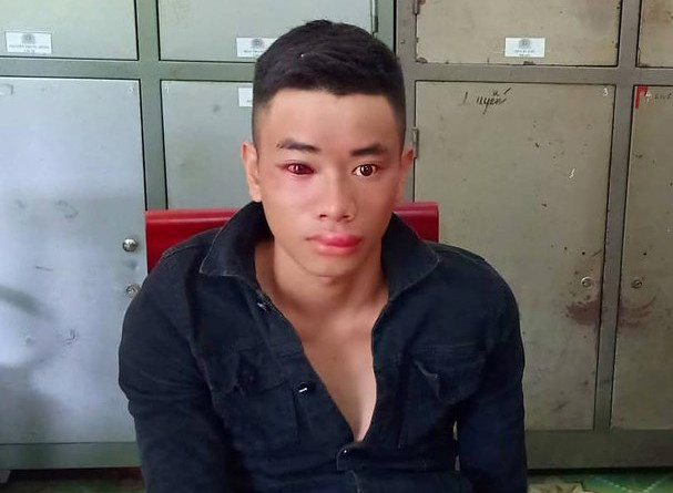 Thiêu úy công an phải chống phơi nhiễm HIV sau khi khống chế 'con nghiện'