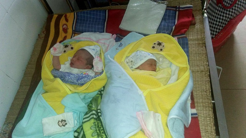 Bệnh viện biên giới mổ thành công ca sinh đôi nguyên bọc ối