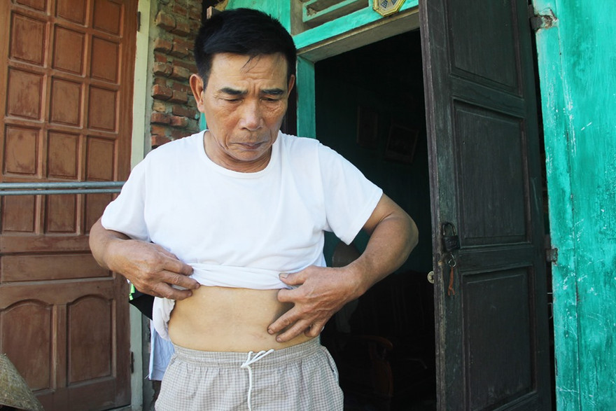 Khôi phục, truy lĩnh chế độ cho 30 thương binh thật ở Nghệ An