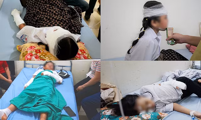 Nguyên nhân bất ngờ vụ bóng bay phát nổ trong ngày khai giảng khiến 10 học sinh bị bỏng