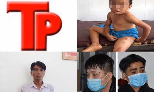 Bản tin Hình sự: Dùng dao, đầu thuốc lá đang cháy bạo hành con riêng của vợ 