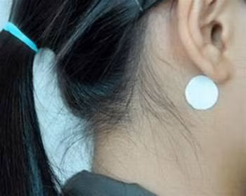 Ai không nên dùng cao dán chống nôn?