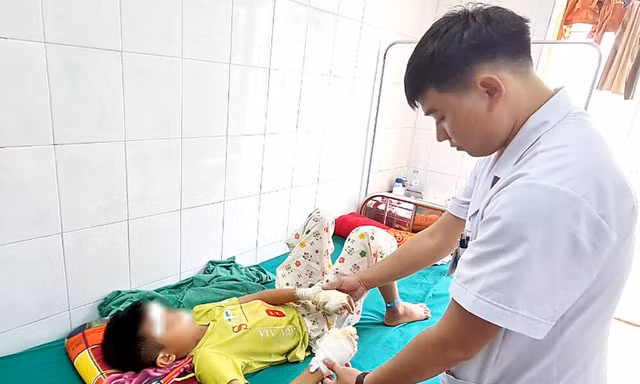 Pin phát nổ, thiếu niên 13 tuổi rách giác mạc, dập nát cả hai tay