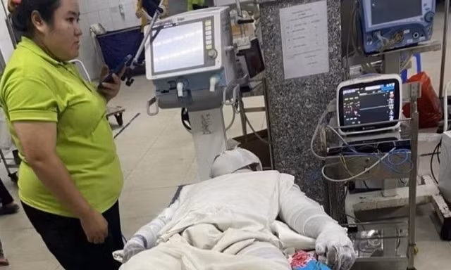 Tin mới vụ nổ bồn trong công ty ở Bình Dương làm nhiều người bị thương