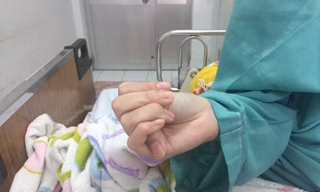 Mổ thành công cho nữ sinh cột sống ngoằn ngoèo như rắn lượn