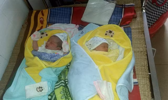 Bệnh viện biên giới mổ thành công ca sinh đôi nguyên bọc ối