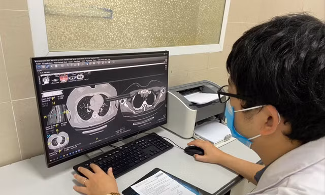 Bác sĩ BV Thanh Nhàn kiểm tra phim chụp phổi của bệnh nhân COVID-19 