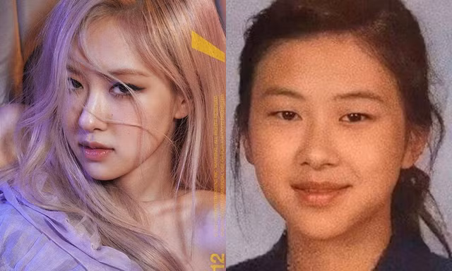 Chỉ vì ảnh teaser quá xinh mà Rosé (BLACKPINK) lại bị netizen nghi ngờ đụng dao kéo