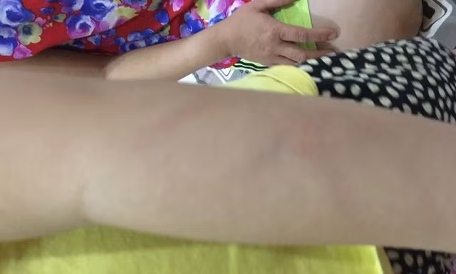 Nghi con bị cô giáo đánh, phụ huynh đòi bồi thường 100 triệu