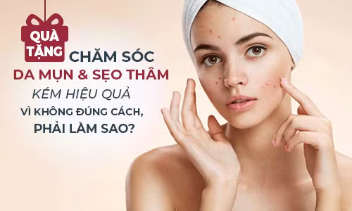 Quà tặng: Da bị mụn và sẹo thâm nên làm gì để “chấm dứt” vĩnh viễn tháng ngày “u tối”?