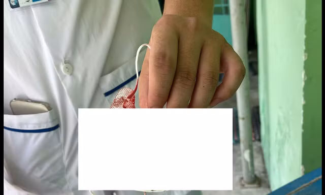 Nữ sinh viên gọi người yêu tới đánh bạn cùng lớp nhập viện