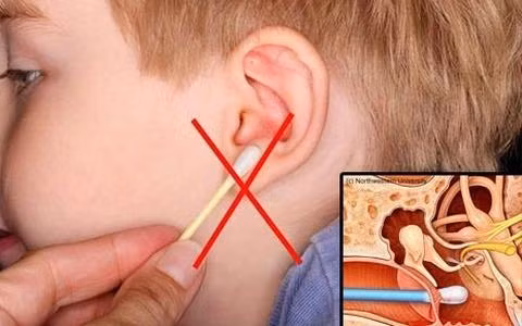 Bỏ ngay những cách lấy ráy tai sai lầm này kẻo điếc vĩnh viễn