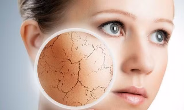 Tránh xa những thực phẩm này vào mùa hè kẻo cơ thể 'héo khô' vì mất nước