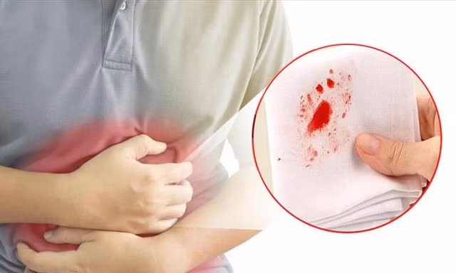 Bất ngờ chảy máu từ những vị trí này, rất có thể bạn đã bị ung thư