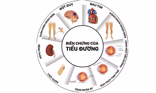 Tìm được độ tuổi khám phát hiện nguy cơ mắc tiểu đường sớm, giảm biến chứng