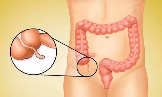 5 công dụng của ruột thừa không phải ai cũng biết