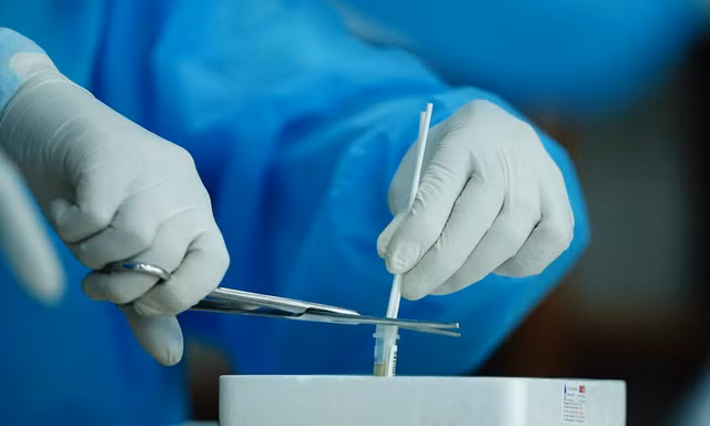 Người dân có thể tự test nhanh tại nhà và cung cấp thông tin trực tuyến cho cơ quan y tế. Ảnh: Phạm Nguyễn