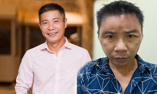 'Hốt hoảng' trước gương mặt sưng vù của NSND Công Lý 