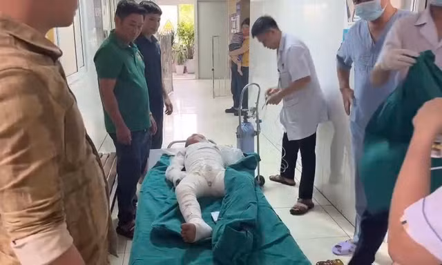 Sử dụng xăng để đốt diệt kiến, hai anh em bỏng nặng