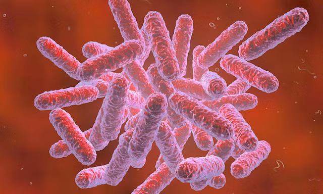 Bệnh Whitmore gây ra bởi vi khuẩn Burkholderia pseudomallei. Ảnh minh hoạ