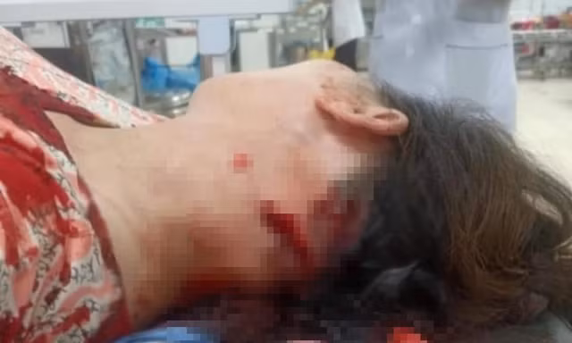 Bà chủ quầy thịt lợn bất ngờ bị người bán hàng rong chém dã man