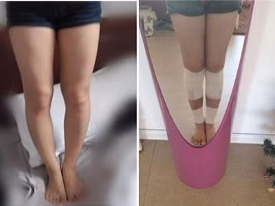 Rợn người cảnh gái trẻ đục chân làm đẹp